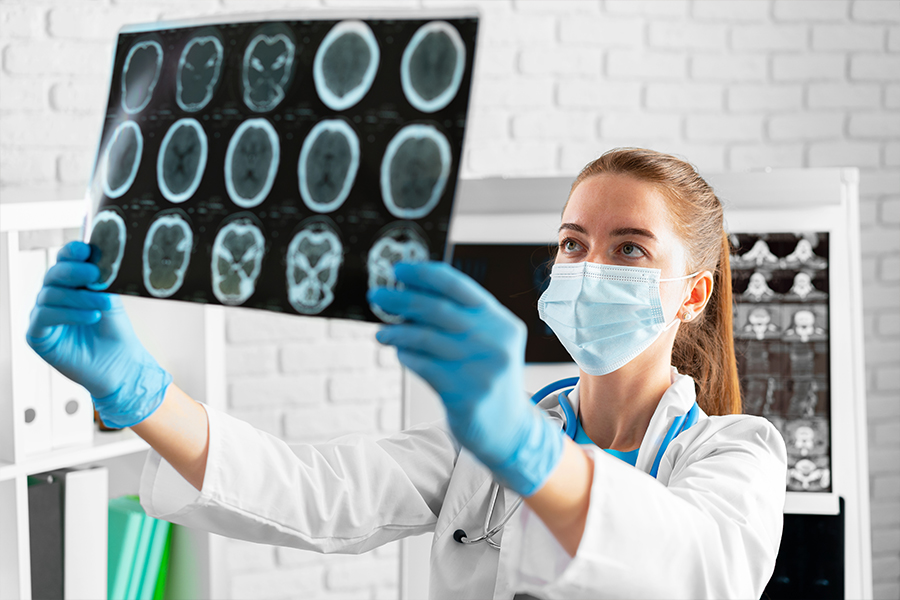 Neurological Effects of Long COVID: What We Know So Far 
